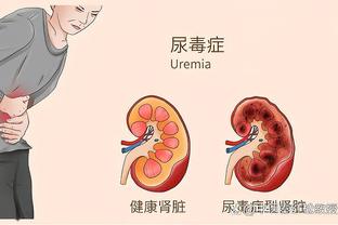 埃迪-豪：伤病给我们造成伤害 尚不清楚特里皮尔的具体伤情